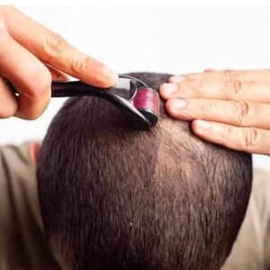 RadBizz Derma Roller and Storage Case - 0.25mm